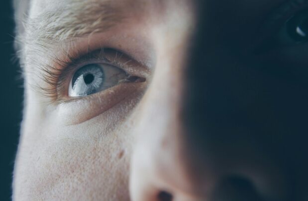 understanding-hunter-eyes-and-negative-canthal-tilt:-a-practical-guide-(2025)